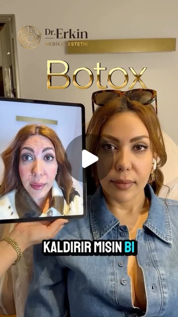 Kaş Kaldırma Botoksu